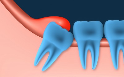 Kavya Dental Clinic